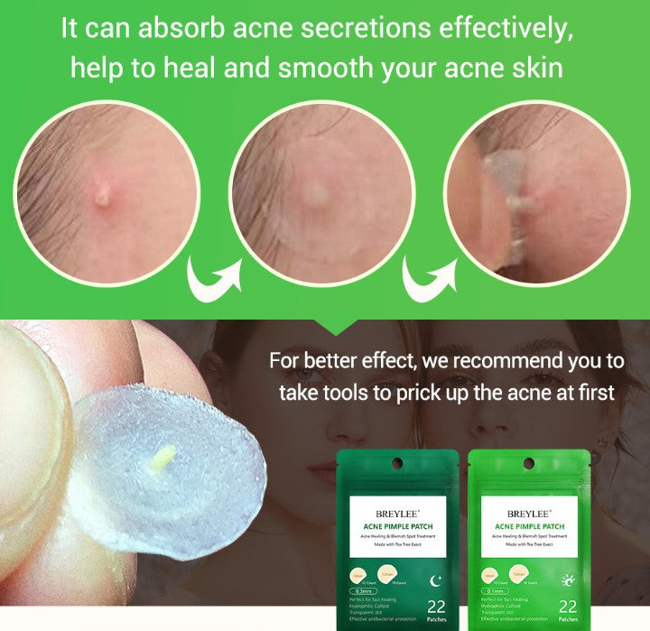 Tea Tree Acne Patch for Fading Marks (Ultra-thin)